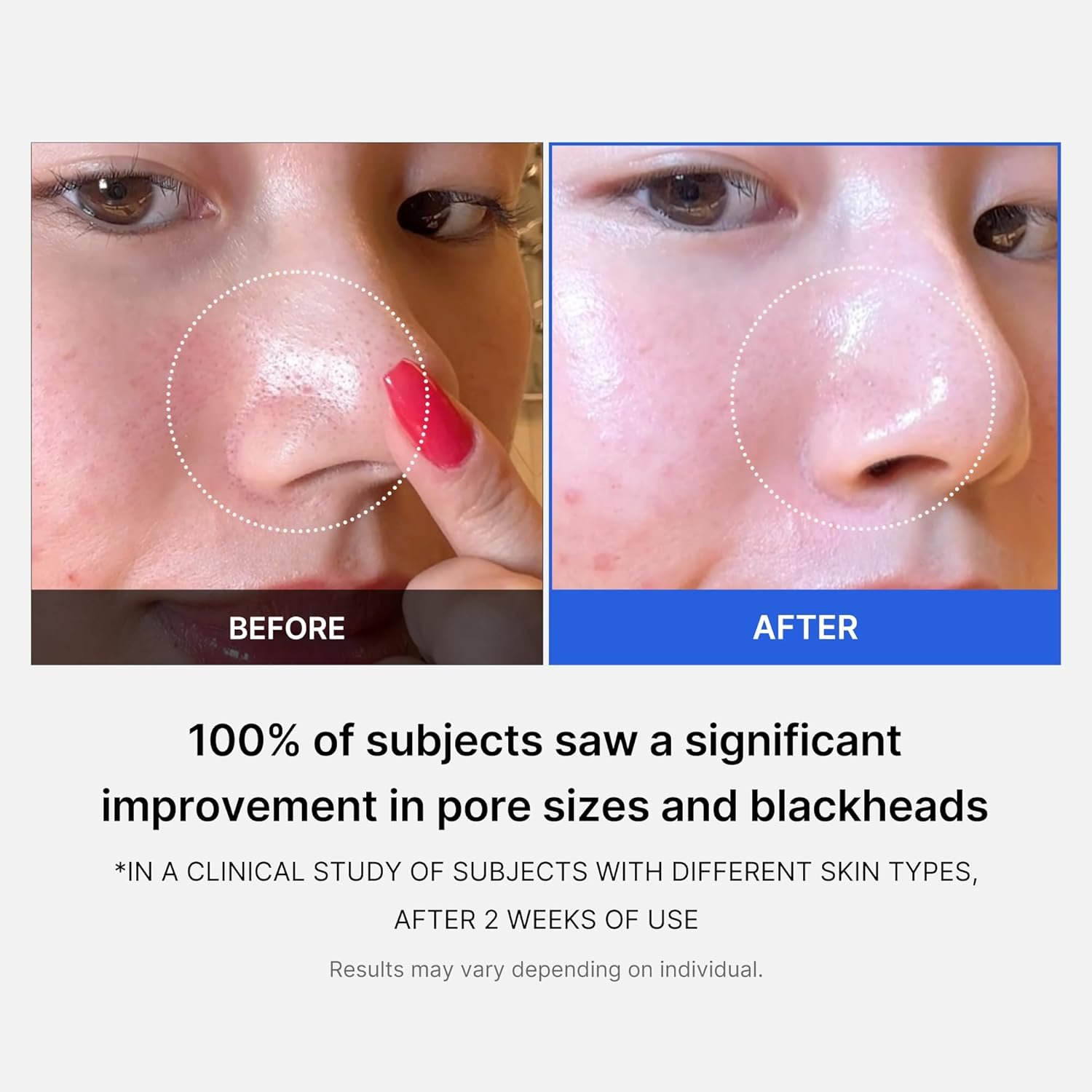 Medicube Zero Pore Pads 2.0, Dual-Textured Facial Toner Pads for Exfoliation and Pore Care with 4.5% AHA Lactic Acid & 0.45% BHA Salicylic Acid, Ideal for All Skin Types, Korean Skin Care (70 Pads) - Image 5