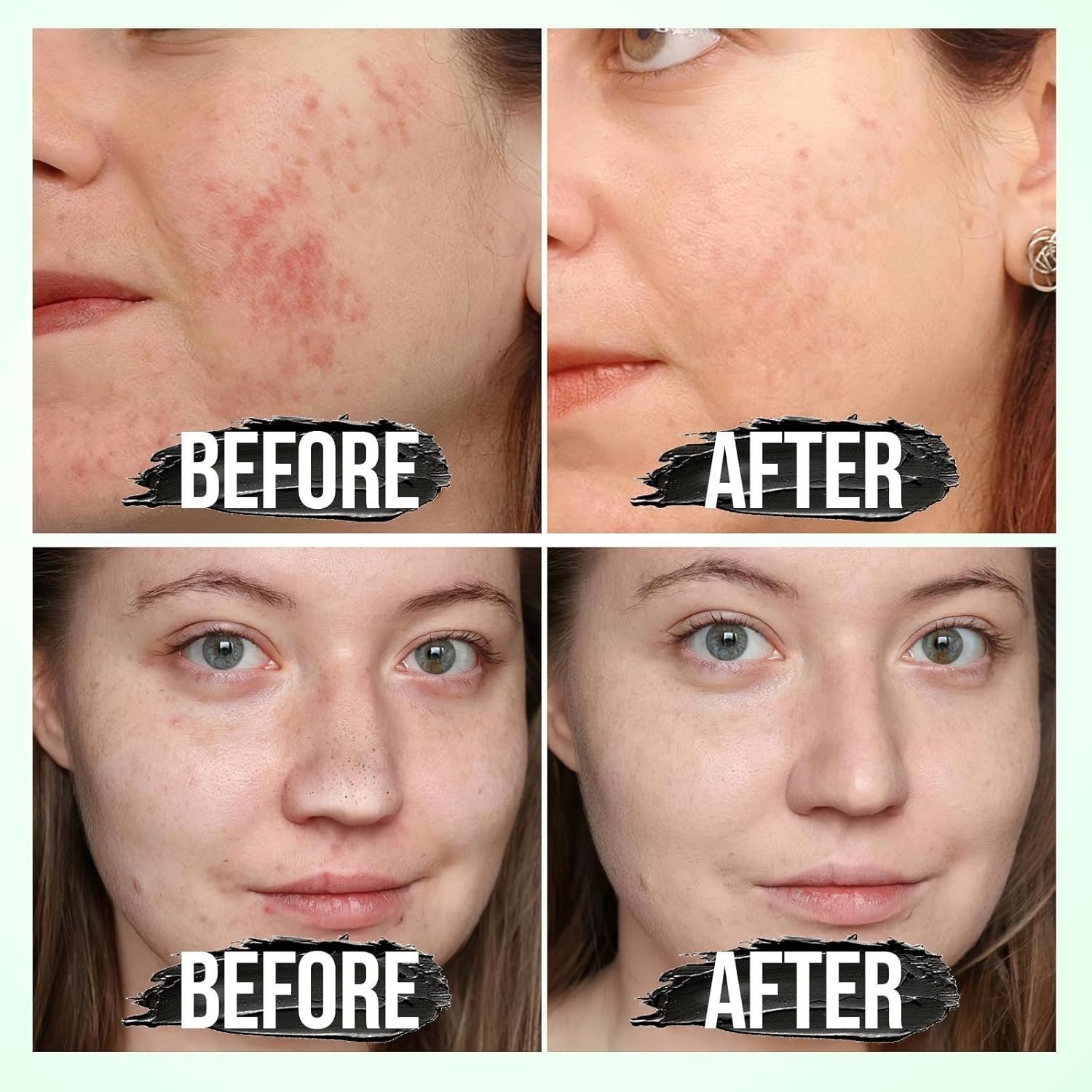 Blackhead Remover Mask, Charcoal Peel Off Facial Mask, Deep Cleansing for Face Skin Care, Nose Back Blackhead Pores Acne, Nose Blackhead Remover Mask, Pore Remover for All Skin Types - Image 4